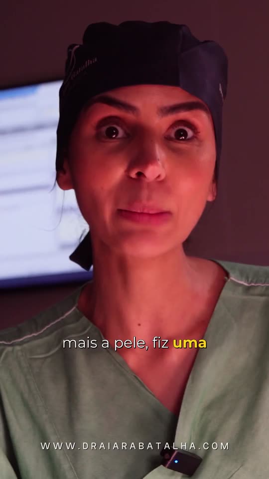 Revisão de cicatriz de abdominoplastia: A cicatriz de cesárea abaixo da abdominoplastia: as duas viraram uma só.