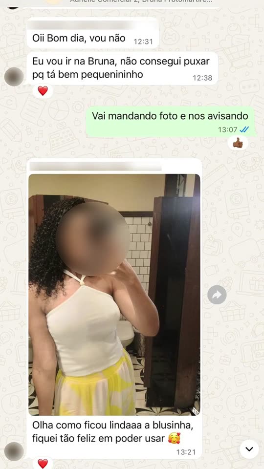 Mastopexia sem prótese: Paciente de 26 anos, com tórax assimétrico e mama muito volumosa e caída: o perfil depois da cirurgia e uma foto dela com cerca de 45 dias.
